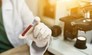 Podwyższone RDW-CV: co oznacza dla twojego zdrowia i diagnozy?