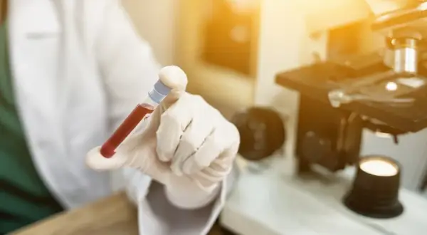 Podwyższone RDW-CV: co oznacza dla twojego zdrowia i diagnozy?